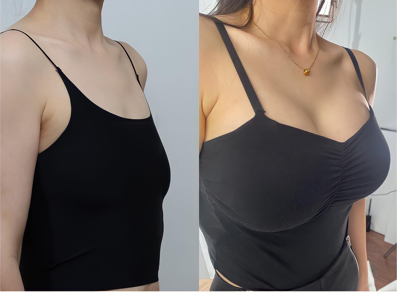 🌟HISKIN® MIKROIGŁOWE PLASTRY UNOSZĄCE I UJĘDRNIAJĄCE BIUST
